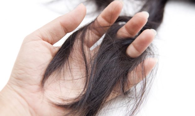 PCOS Hair Loss – Cause, Treatment and Home Remedies